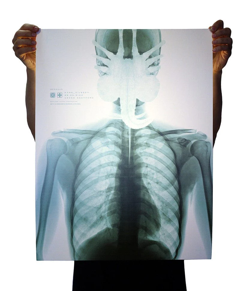 Alien
