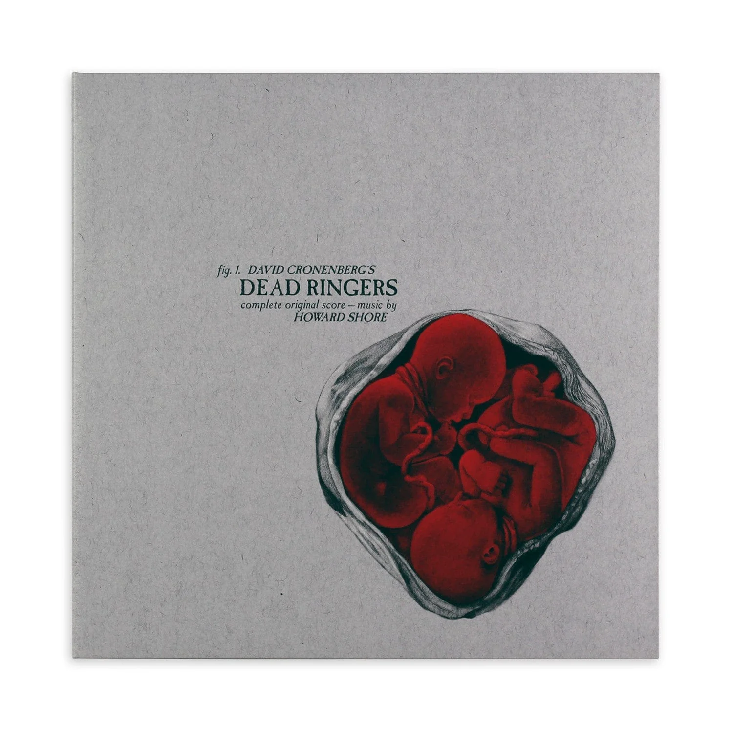 Dead Ringers – Original Motion Picture Soundtrack LP (Version B) - Image 6